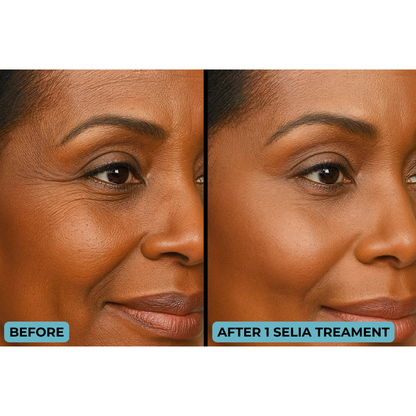 Selia – Gold Microneedling Treatment